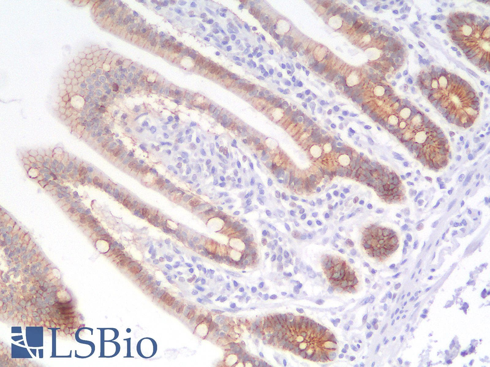 PathPlus™ CDH1 / E Cadherin Antibody (clone rCDH1/1525)