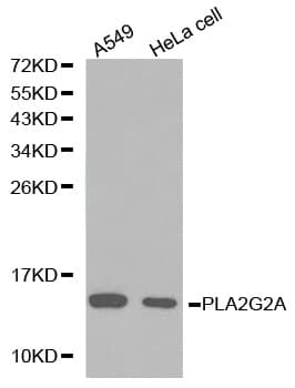 Polyclonal Rabbit anti-Human PLA2G2A / SPLA2 Antibody (IHC, WB)