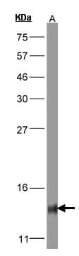 COX5B Antibody (aa1-129)