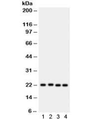 Polyclonal Rabbit anti-Human SOCS2 Antibody (WB)
