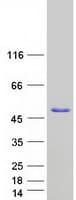 Human NEIL2 Protein (Recombinant Myc-DDK (Flag))
