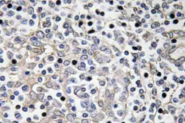 Polyclonal Rabbit anti-Human IL16 Antibody (Gly97, IHC)