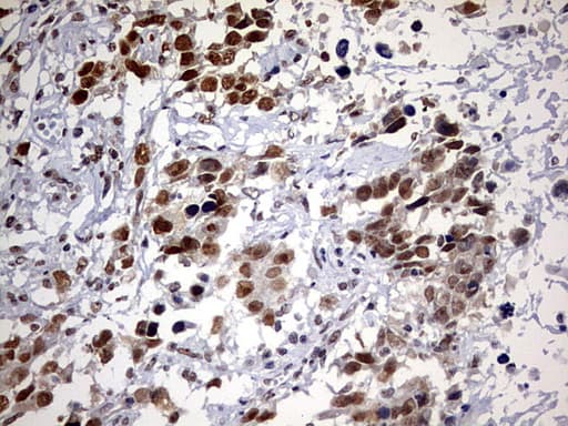 DDX56 Antibody (aa323-547, clone OTI5C1)