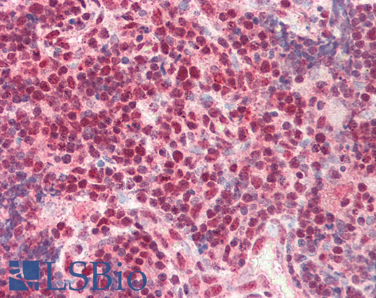 CTBP1 / CTBP Antibody (C-Terminus)