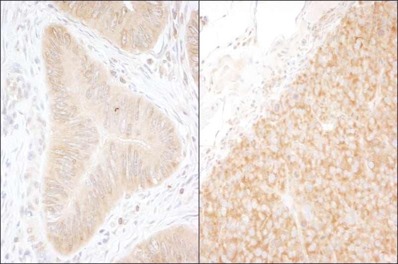 Polyclonal Rabbit anti-Human DDX6 Antibody (aa1-50, IHC, WB)