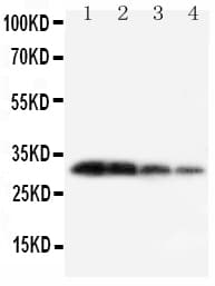 KLK1 / Kallikrein 1 Antibody (aa243-261)