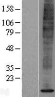 SPCS1 Protein (Over-Expression Lysate Myc-DDK (Flag))
