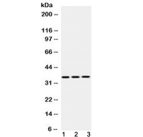 EMD / Emerin Antibody
