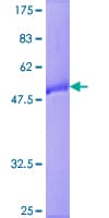 Human RAB9B Protein (Recombinant GST)
