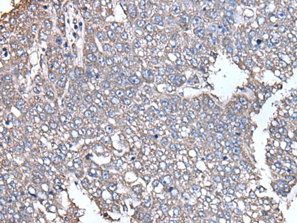 SCP2 / SCPX Antibody