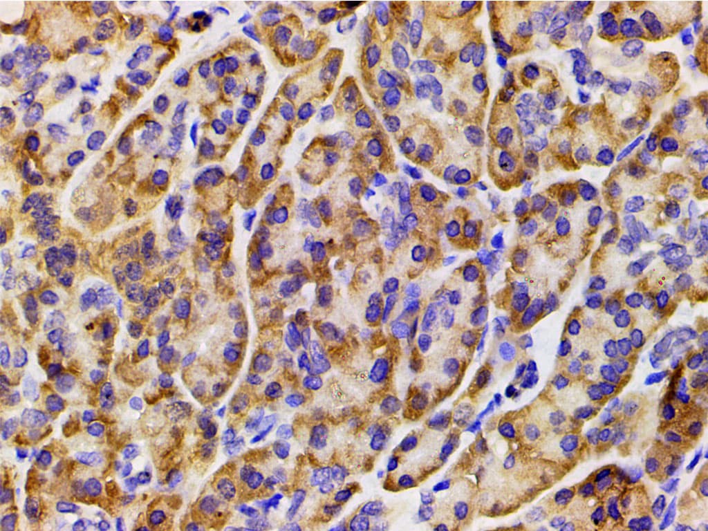 PIK3R1 / p85 Alpha Antibody (phospho-Tyr607)