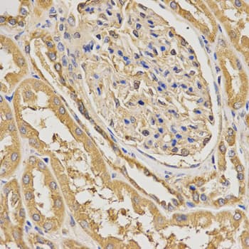 BAIAP2 / IRSP53 Antibody
