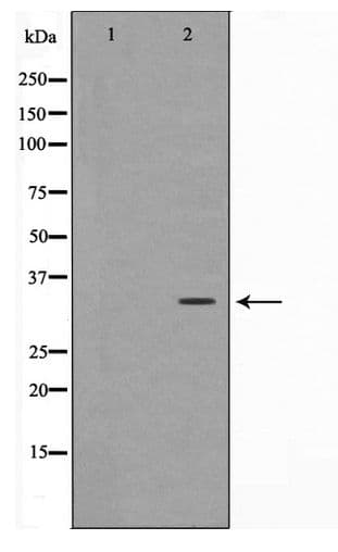 Polyclonal Rabbit anti-Human FOXE2 / FOXE1 Antibody (WB)