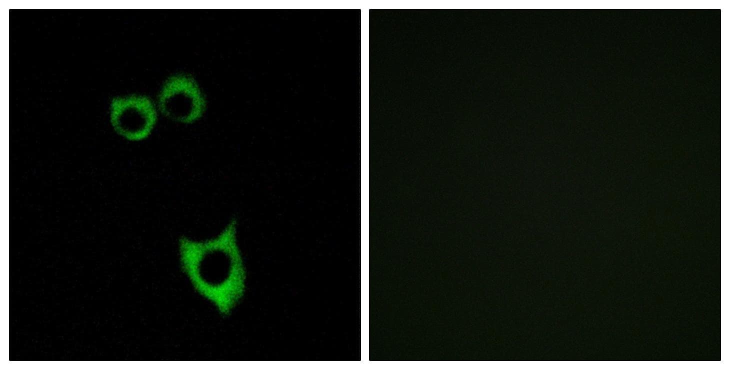 VPAC2 / VIPR2 Antibody