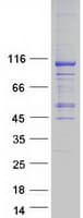 Human AARS2 Protein (Recombinant Myc-DDK (Flag))