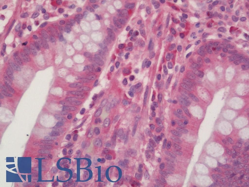 PathPlus™ PDGFRB / PDGFR Beta Antibody (clone RBT-PDGFRB)