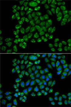 GRIA3 / GLUR3 Antibody