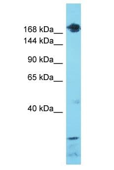 SETD1A / SET1 Antibody (aa1330-1379)