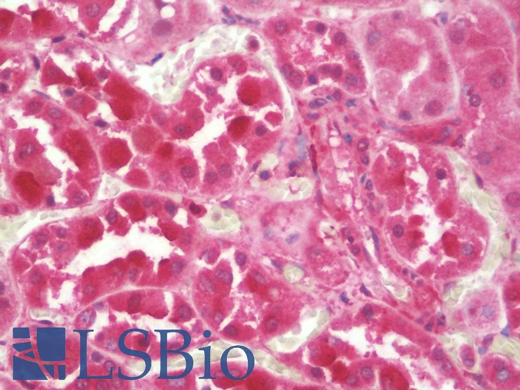 IHC-plus™ KANK2 Antibody
