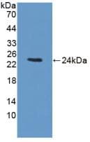 BCKDK Antibody (aa44-223, PE)