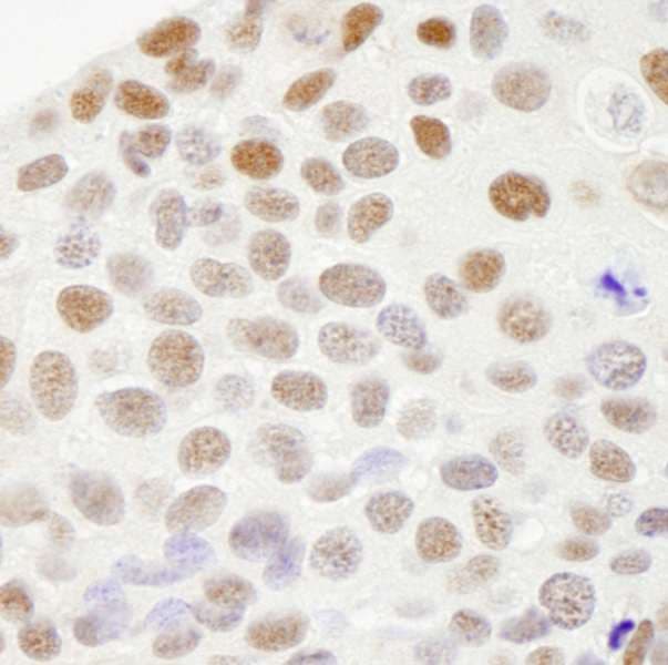 RECQ1 / RECQL Antibody (aa600-C-term)