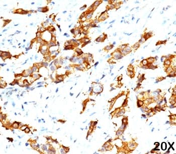 Monoclonal Mouse anti-Human HSPB1 / HSP27 Antibody (clone G3.1, Ready-to-Use, IHC, IF, WB)