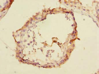 TRIM69 / Trif Antibody