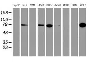 PFKP Antibody (clone OTI2F2, Carrier-free)