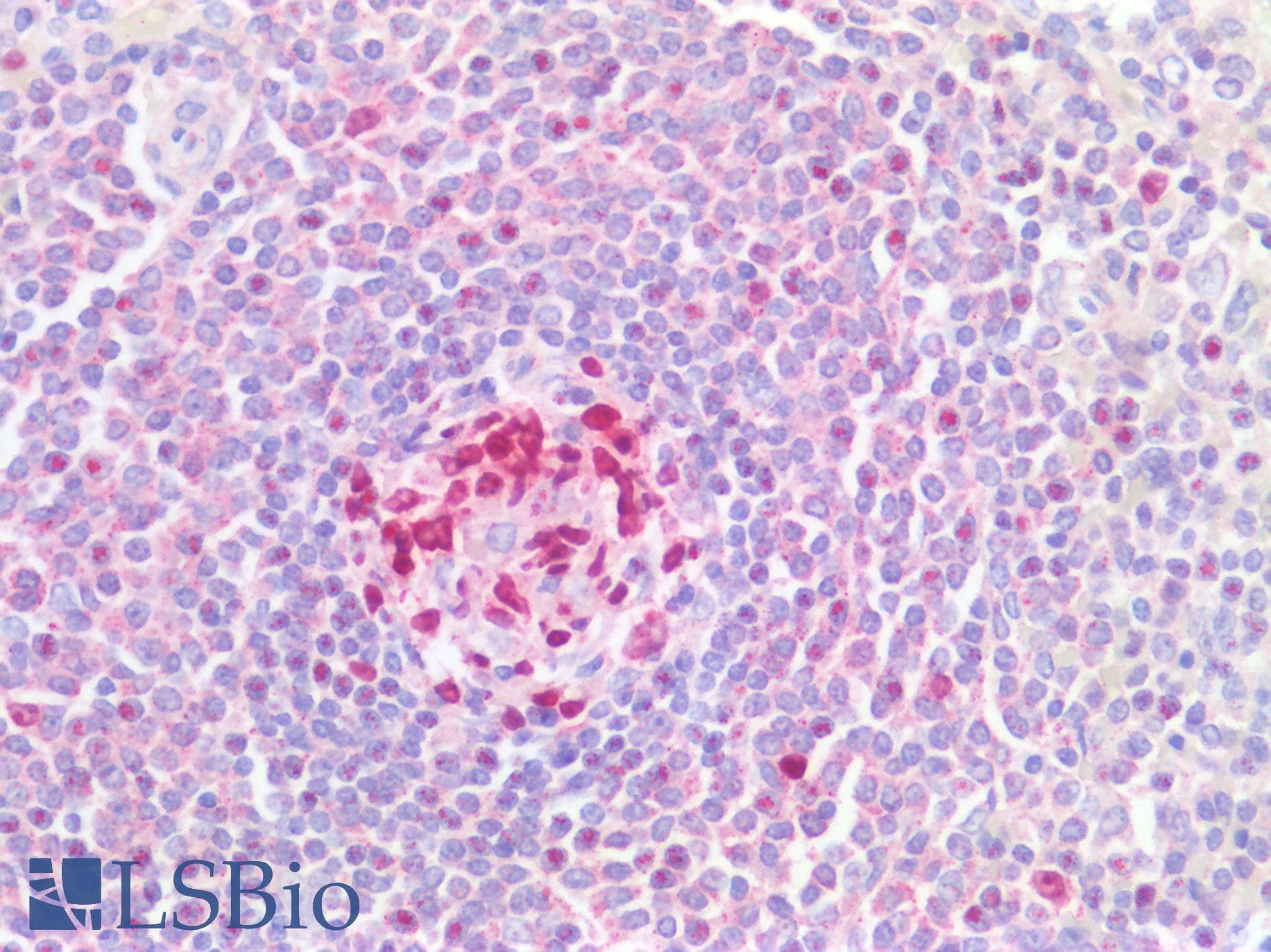 PathPlus™ MKI67 / Ki67 Antibody (clone 19, Preservative Free)