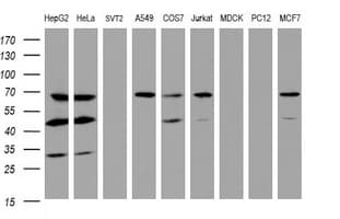 ILVBL Antibody (clone OTI3E9)
