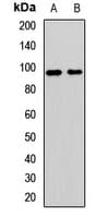 Polyclonal Rabbit anti-Human GLI2 Antibody (WB)