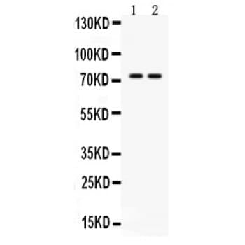 ZBTB7A / Pokemon Antibody (aa125-163)