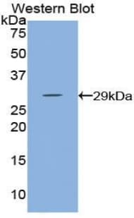 HK3 / Hexokinase 3 Antibody (aa673-903, Cy3)