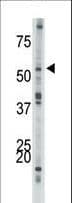 ACVR1B / ALK4 Antibody (aa39-68)