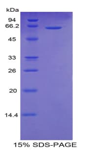 Human CD95 / FAS Protein (Recombinant His-MBP)