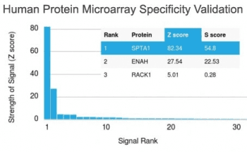 SPTA1 / Alpha Spectrin Antibody (clone SPTA1/1832)
