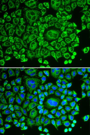 ARHGDIA / RHOGDI Antibody