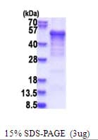 Human CSNK1D Protein (Recombinant His)