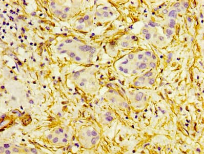 ACTA2 / Smooth Muscle Actin Antibody