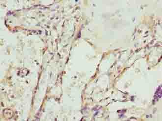 Polyclonal Rabbit anti-Human SPCS3 Antibody (IHC)
