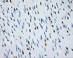 RPA2 / RFA2 / RPA34 Antibody (clone OTI9A1)