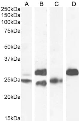 Polyclonal Goat anti-Human TNNI3 / Cardiac Troponin I Antibody (aa117-127, IF, WB)