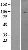 AFTPH Protein (Over-Expression Lysate Myc-DDK (Flag))