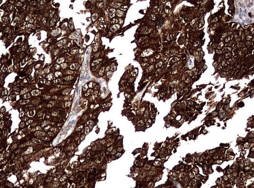 NME1 / NM23 Antibody (clone UMAB94)