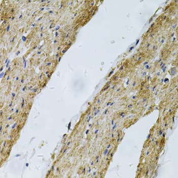 Polyclonal Rabbit anti-Human VCL / Vinculin Antibody (IHC, WB)