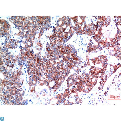 BECN1 / Beclin-1 Antibody