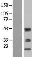 ACY1 / Aminoacylase 1 Protein (Over-Expression Lysate Myc-DDK (Flag))