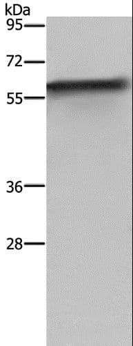 Polyclonal Rabbit anti-Human FKBP38 / FKBP8 Antibody (IHC, WB)