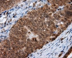HMRF1L / MTRF1L Antibody (clone OTI1B3, Carrier-free)