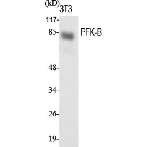 PFKL Antibody (660-740 aa, C-terminal)